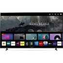 LG 75" UR78 UHD 4K Smart TV | 75UR78006LK.AEK LG Euronics.ie